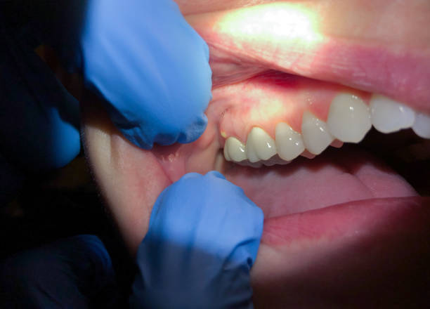 Best Emergency Dental Care for Trauma or Injury in Annandale, MN