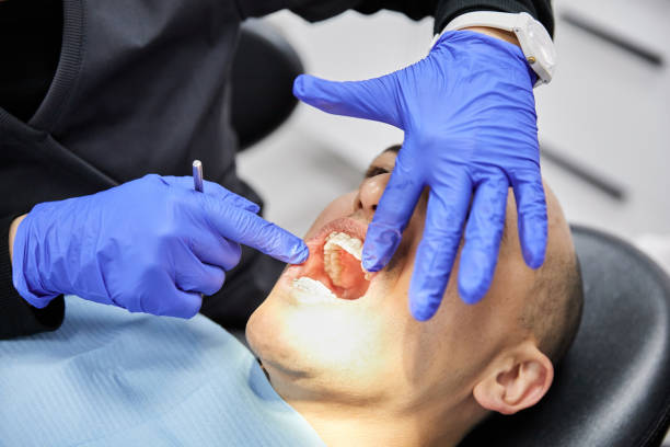 Best After-Hours Emergency Dentist in Annandale, MN